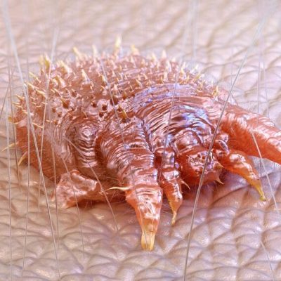 disinfestazione-scabbia-a-Salerno